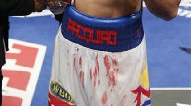 manny-pacquiao-shorts-auction